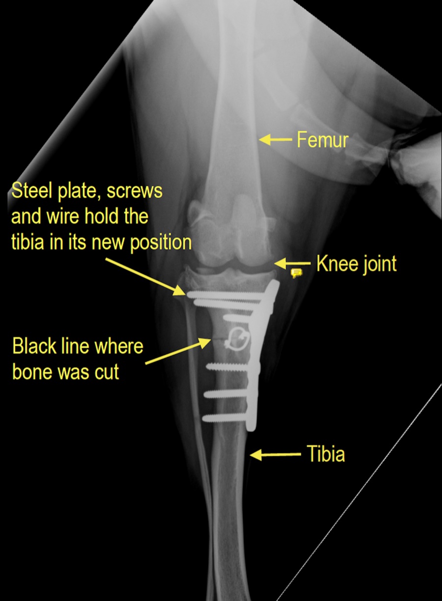 Post-operative CrCa view annotated