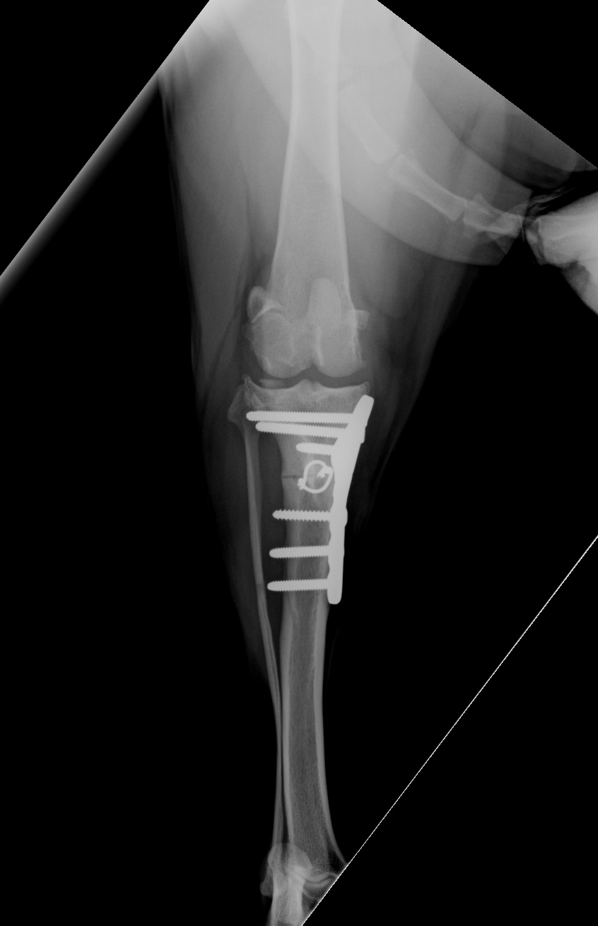 Post-operative CrCa view