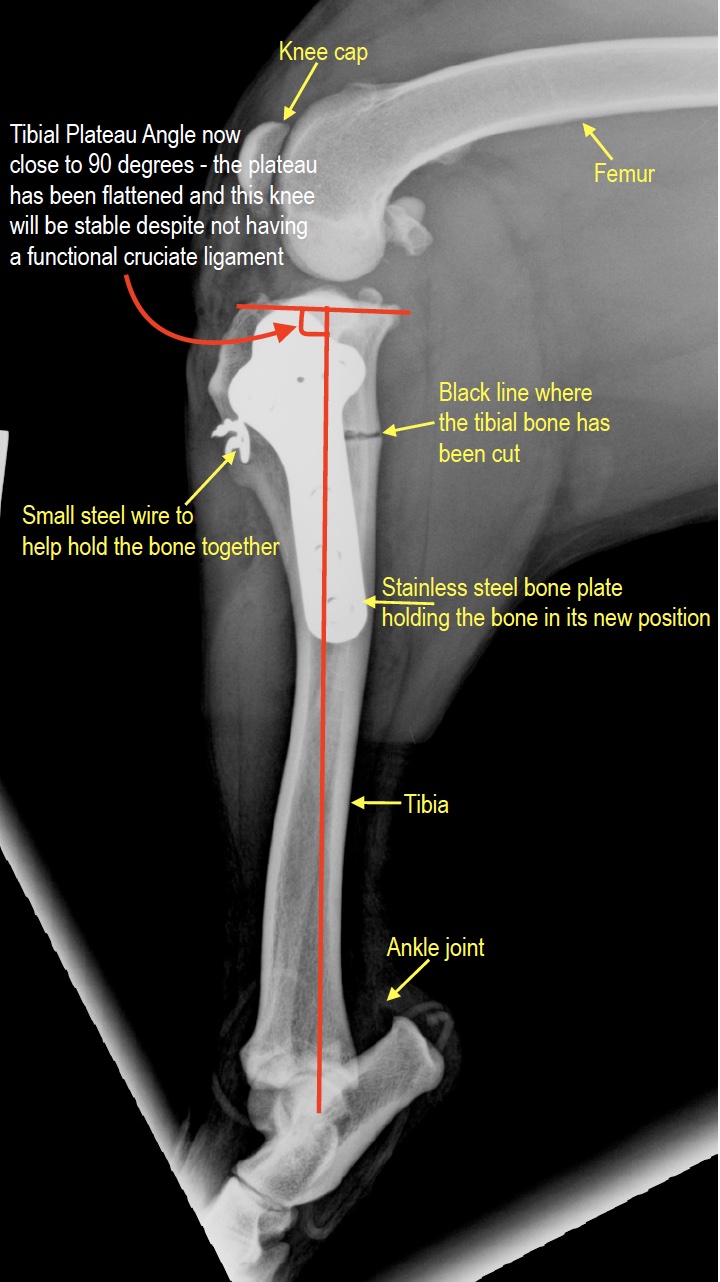 Post-operative ML view annotated