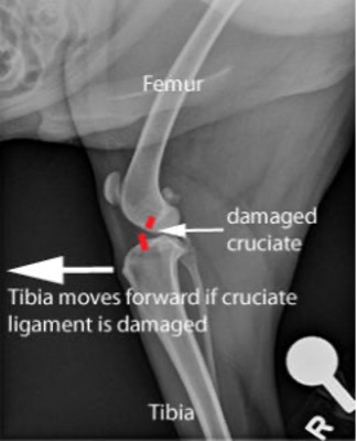 Diagram showing the tibia moving forward when the cruciate ligament is damaged